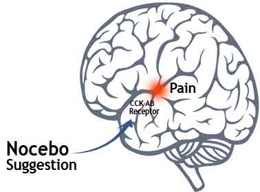 Nocebo effect in brain